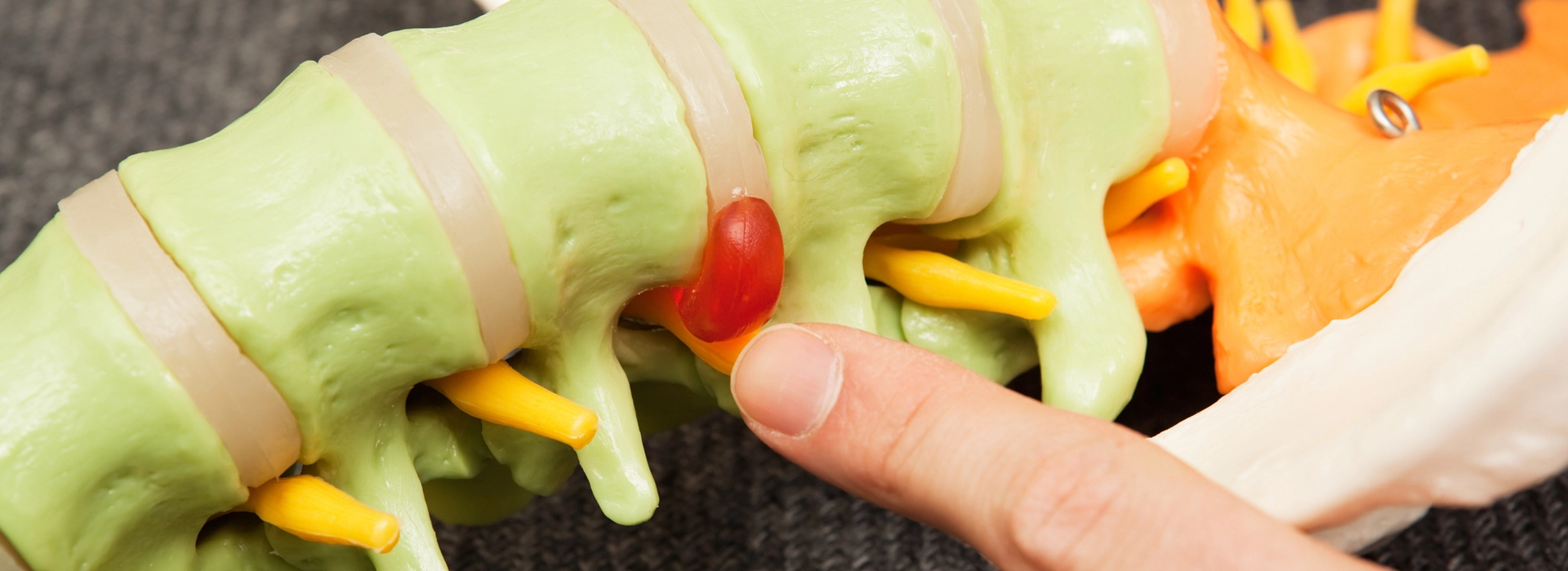 Herniated Disc Banner Image
